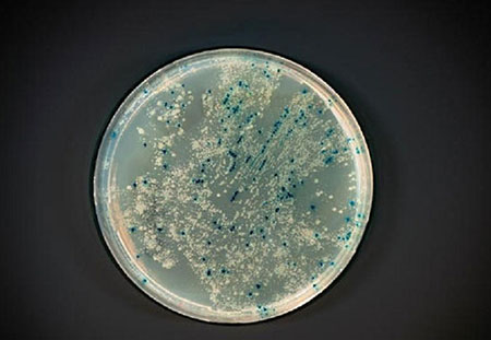 人体细菌群落十大鲜为人知的秘密人体细菌群落十大鲜为人知的秘密