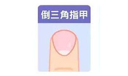 从指甲形状知性格 正方外形性格正直从指甲形状知性格 正方外形性格正直