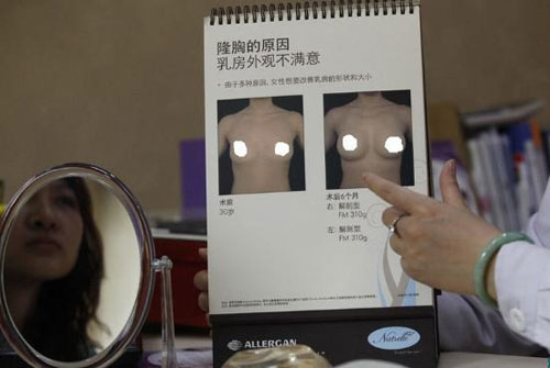东莞平胸浴足小姐隆胸手术全程实录0202.jpg