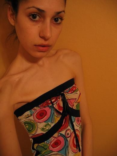 美女过度减肥到成干尸11.jpg