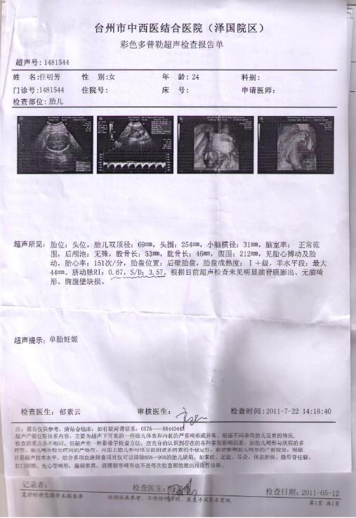 孕27周三维单显示 脐动脉ri 0.