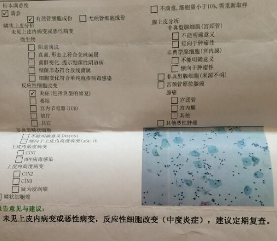 下体有黄色脓性,血丝,偶尔带有白色分泌物问题已结束讨论