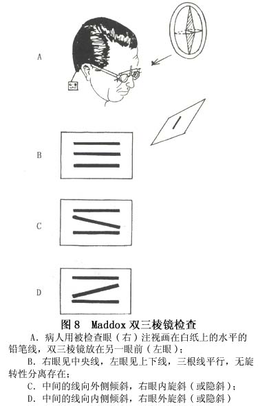 ①检查两眼水平肌力过程中作内,外隐斜检查时,将马氏杆横放一眼前