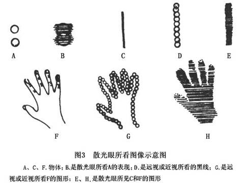 散光怎么加到镜片上,散光怎么加到镜片上的